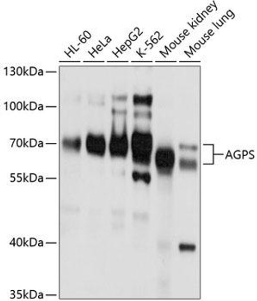 Metabolism Antibodies 1 Anti-AGPS Antibody CAB10484