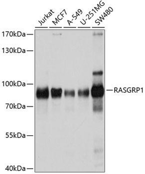 Developmental Biology Anti-RASGRP1 Antibody CAB10495