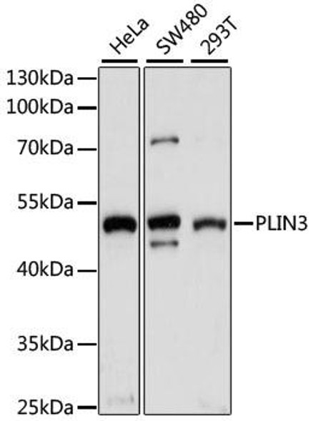 Signal Transduction Antibodies 1 Anti-PLIN3 Antibody CAB1050