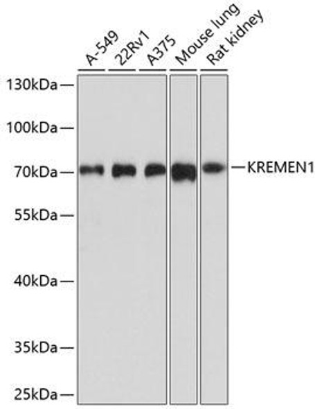 Metabolism Antibodies 1 Anti-KREMEN1 Antibody CAB10507