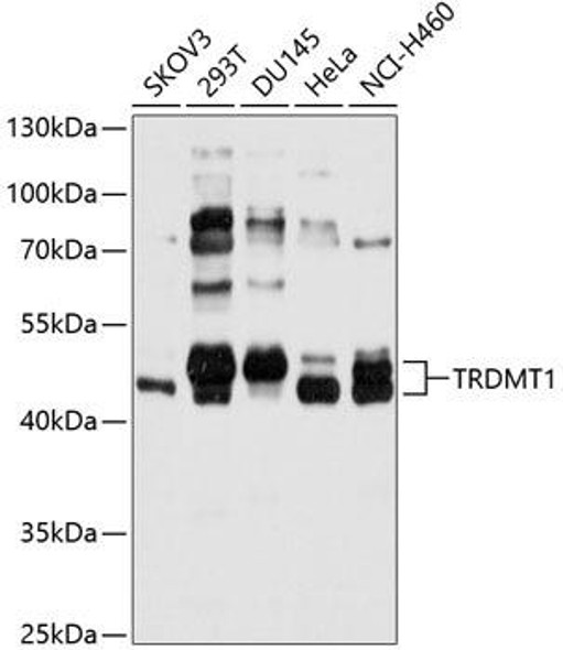 Epigenetics and Nuclear Signaling Antibodies 1 Anti-TRDMT1 Antibody CAB10535
