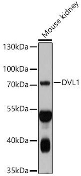 Metabolism Antibodies 1 Anti-DVL1 Antibody CAB10536