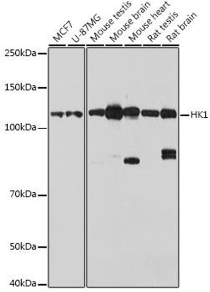 KO Validated Antibodies 1 Anti-HK1 Antibody CAB1054KO Validated