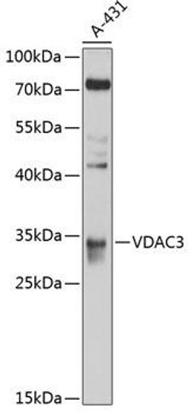 Signal Transduction Antibodies 1 Anti-VDAC3 Antibody CAB10544