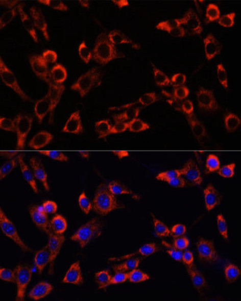 Cell Biology Antibodies 2 Anti-LGR5 Antibody CAB10545