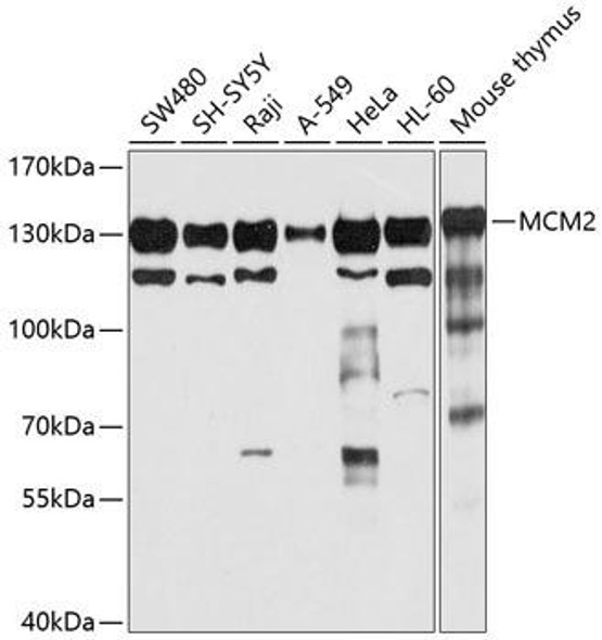 Cell Cycle Antibodies 1 Anti-MCM2 Antibody CAB1056