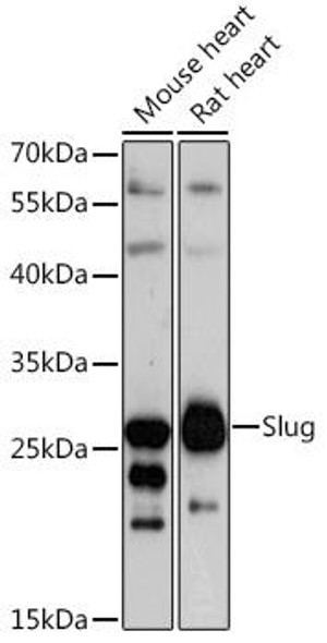 Epigenetics and Nuclear Signaling Antibodies 1 Anti-Slug Antibody CAB1057