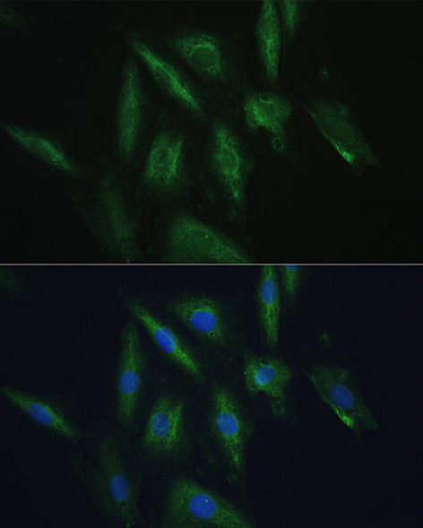 Cell Biology Antibodies 2 Anti-SRPRB Antibody CAB10591