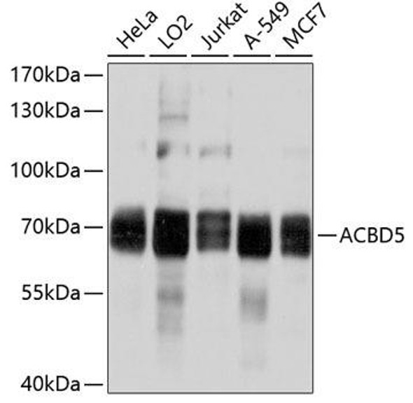 Autophagy Antibodies Anti-ACBD5 Antibody CAB10595