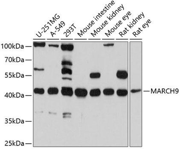 Signal Transduction Antibodies 1 Anti-MARCH9 Antibody CAB10596