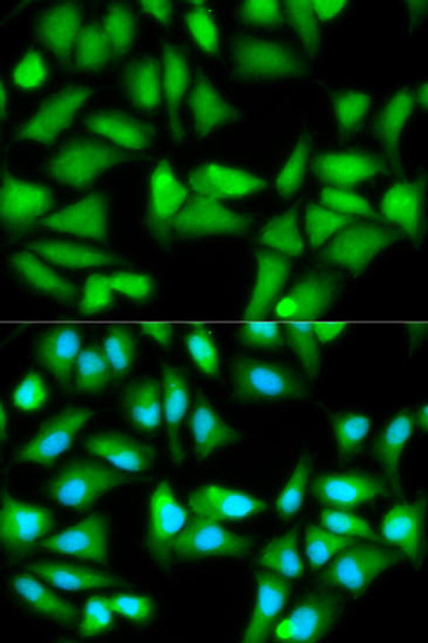 Metabolism Antibodies 1 Anti-GSS Antibody CAB1069