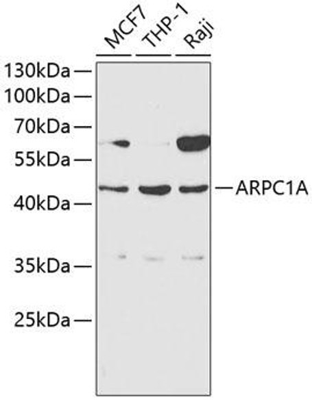 Cell Biology Antibodies 2 Anti-ARPC1A Antibody CAB1070