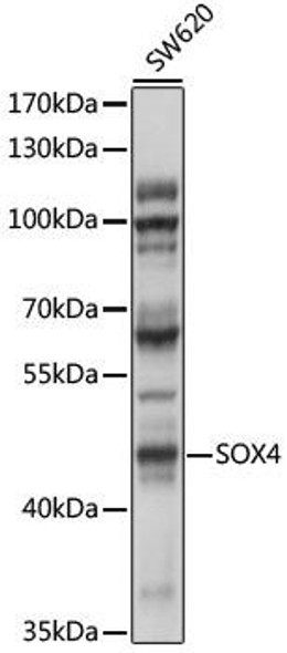 Epigenetics and Nuclear Signaling Antibodies 1 Anti-SOX4 Antibody CAB10717