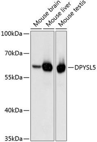 Cell Biology Antibodies 2 Anti-DPYSL5 Antibody CAB10734