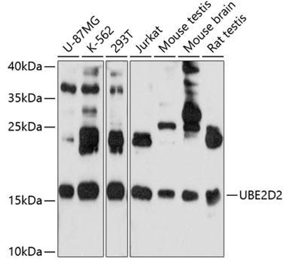Signal Transduction Antibodies 1 Anti-UBE2D2 Antibody CAB10818
