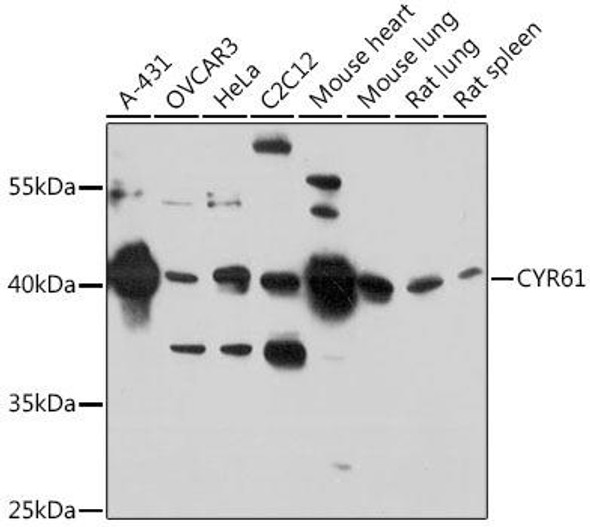 Cell Biology Antibodies 2 Anti-CYR61 Antibody CAB1111