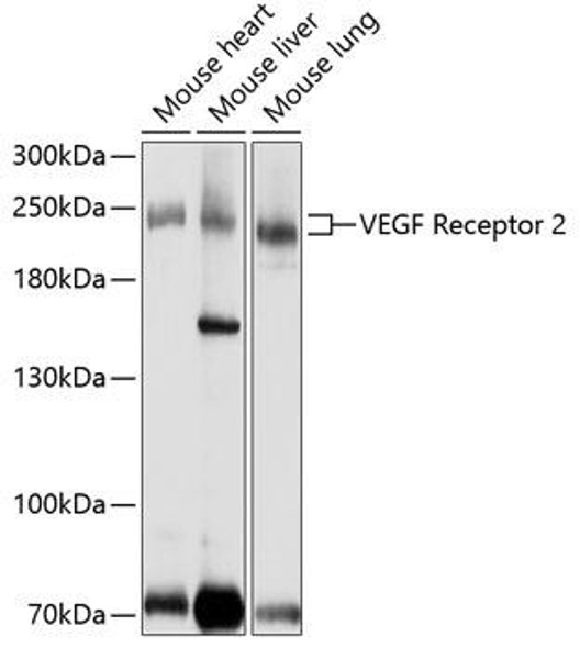 Cardiovascular Antibodies Anti-VEGF Receptor 2 Antibody CAB11127
