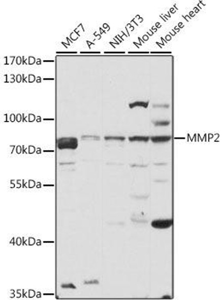 Cardiovascular Antibodies Anti-MMP2 Antibody CAB11144
