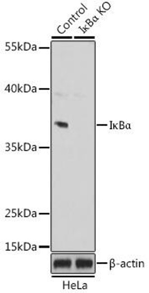 KO Validated Antibodies 1 Anti-IkBAlpha Antibody CAB11168KO Validated