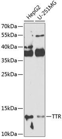 Signal Transduction Antibodies 1 Anti-TTR Antibody CAB1120