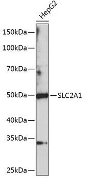 Signal Transduction Antibodies 1 Anti-SLC2A1 Antibody CAB11208