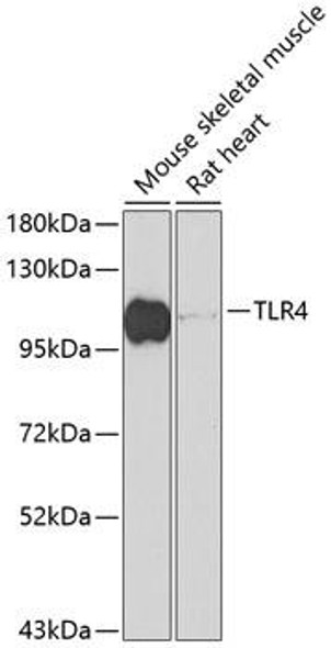 KO Validated Antibodies 1 Anti-TLR4 Antibody CAB11226KO Validated