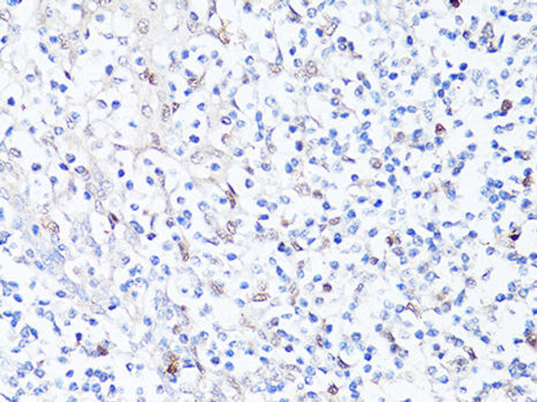 Cell Death Antibodies 1 Anti-SQSTM1 / p62 Antibody CAB11250