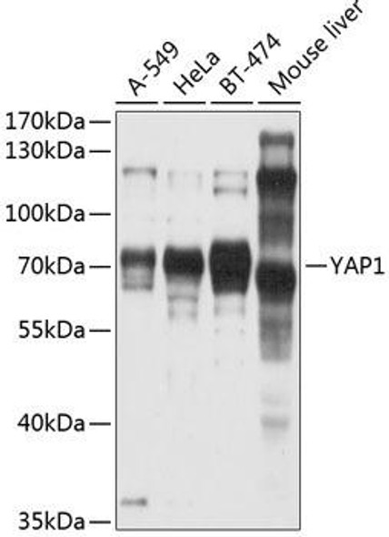 KO Validated Antibodies 1 Anti-YAP1 Antibody CAB11264KO Validated
