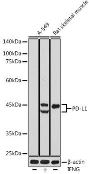 Immunology Antibodies 1 Anti-PD-L1 Antibody CAB11273