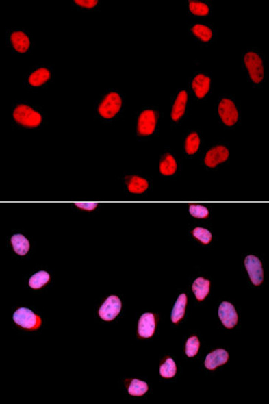 Cell Cycle Antibodies 1 Anti-CDC25C Antibody CAB11328