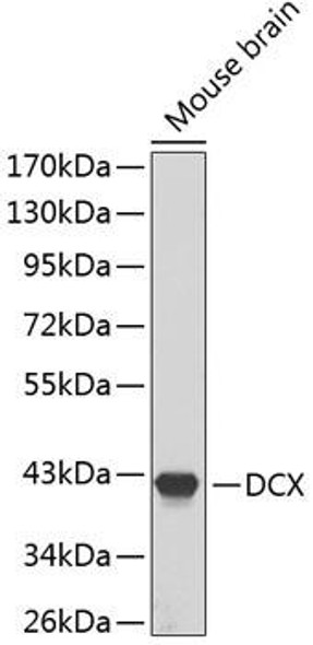 Developmental Biology Anti-DCX Antibody CAB1134