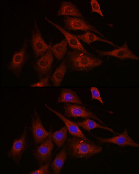 Cell Biology Antibodies 2 Anti-mTOR Antibody CAB11355