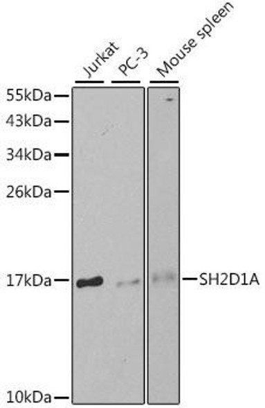 Immunology Antibodies 1 Anti-SH2D1A Antibody CAB1143
