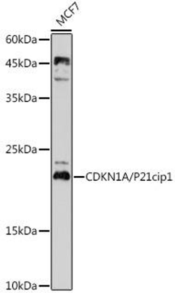 Cell Cycle Antibodies 1 Anti-CDKN1A/p21CIP1 Antibody CAB11454