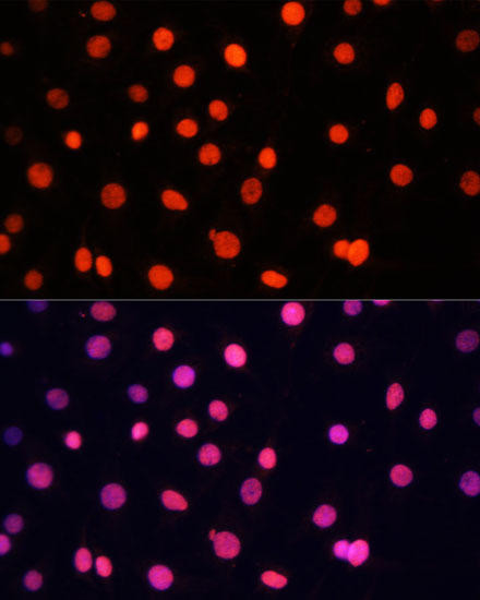 Epigenetics and Nuclear Signaling Antibodies 1 Anti-SOX2 Antibody CAB11501