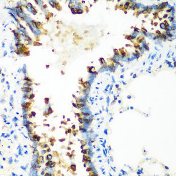 Cell Biology Antibodies 2 Anti-MTCO2 Antibody CAB11522