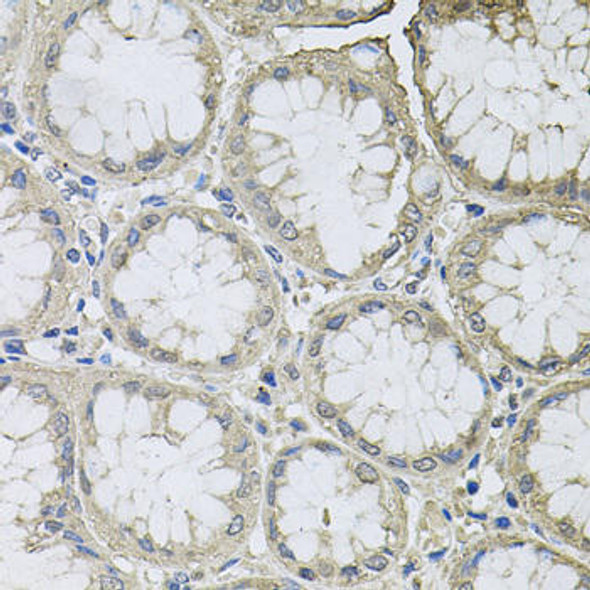 Cell Death Antibodies 1 Anti-Bcl-W Antibody CAB1158