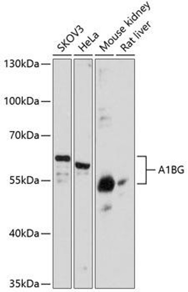 Cell Biology Antibodies 2 Anti-A1BG Antibody CAB11583