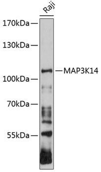 Cell Biology Antibodies 2 Anti-MAP3K14 Antibody CAB11585