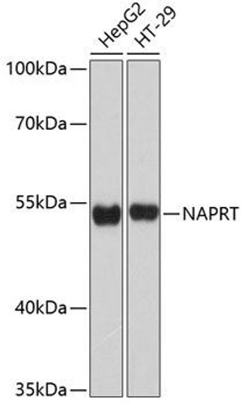 Metabolism Antibodies 1 Anti-NAPRT Antibody CAB11591