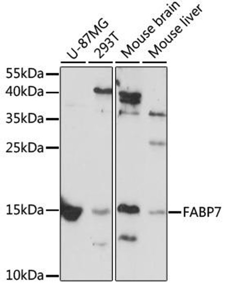 Signal Transduction Antibodies 1 Anti-FABP7 Antibody CAB11604