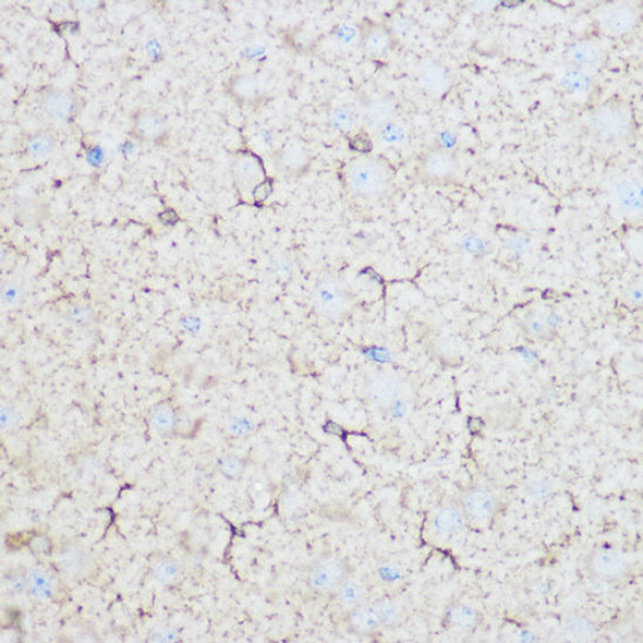 Metabolism Antibodies 1 Anti-ALDOC Antibody CAB11618