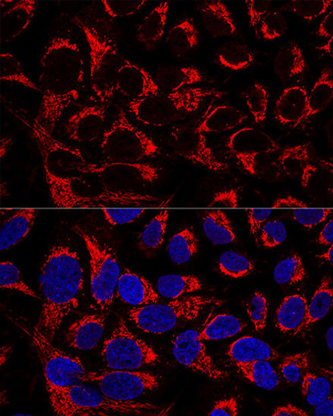 Cell Biology Antibodies 2 Anti-OCIAD1 Antibody CAB11630