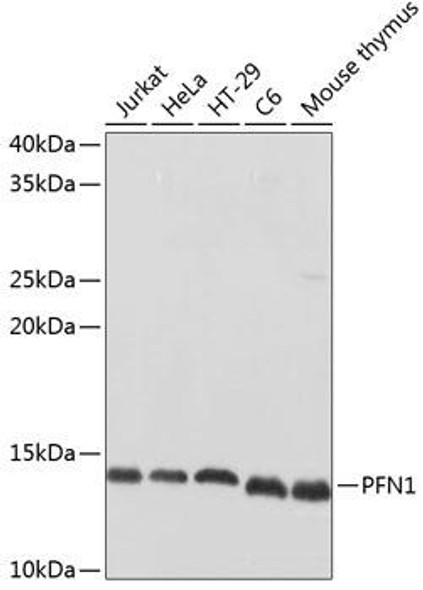 Cell Biology Antibodies 2 Anti-PFN1 Antibody CAB1164