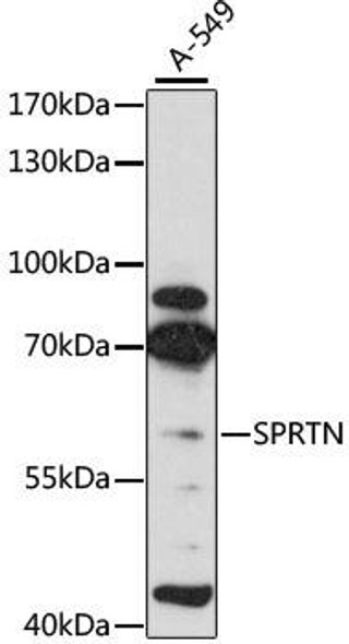 Epigenetics and Nuclear Signaling Antibodies 1 Anti-SPRTN Antibody CAB11663