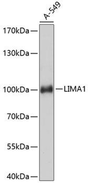 Metabolism Antibodies 1 Anti-LIMA1 Antibody CAB11682