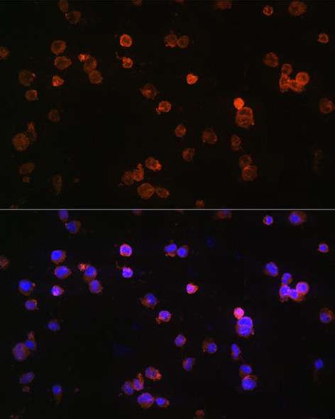 Signal Transduction Antibodies 1 Anti-P2RX5 Antibody CAB11710