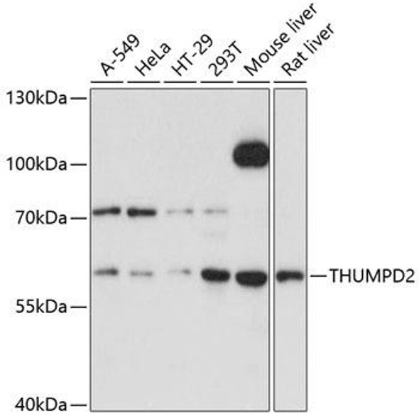 Cell Biology Antibodies 2 Anti-THUMPD2 Antibody CAB11717