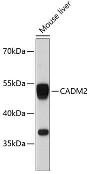 Cell Biology Antibodies 2 Anti-CADM2 Antibody CAB11724