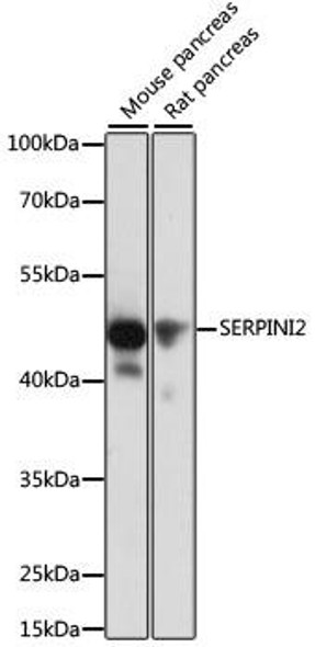 Cell Biology Antibodies 2 Anti-SERPINI2 Antibody CAB11732